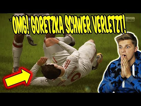 GORETZKA VERLETZT! Nächste schlimme VERLETZUNG! ⚽? Fifa 18 Karrieremodus Fc Bayern FifaGaming #52