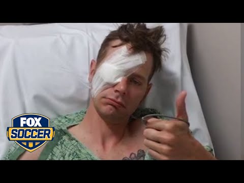 Fan gets glass eye with hand-painted Bayern logo on it | FOX SOCCER